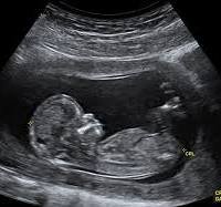 Ultrasonography